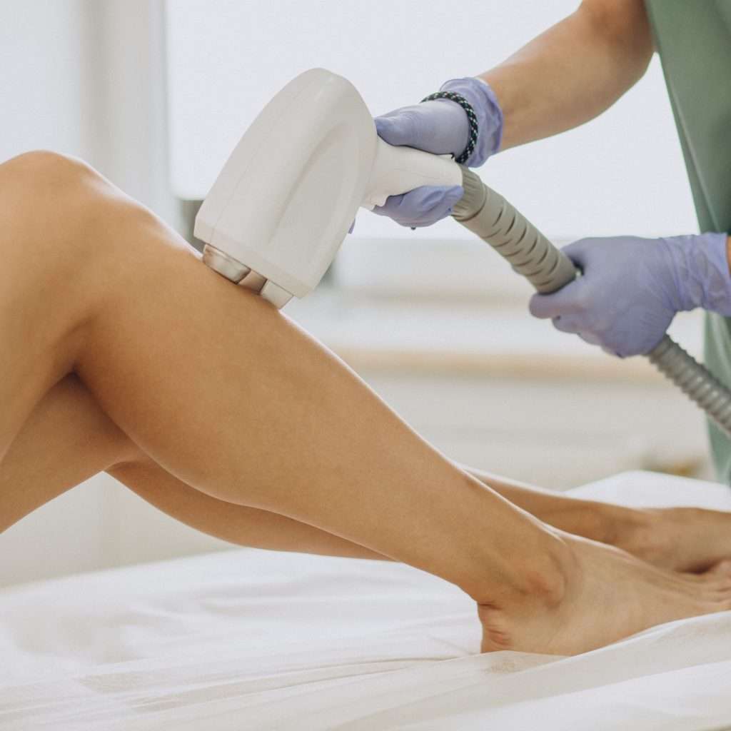 Laser hair removal treatments